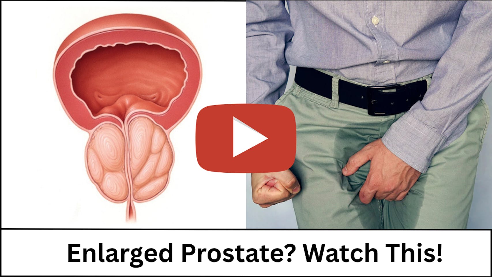 Enlarged Prostate? Watch This!